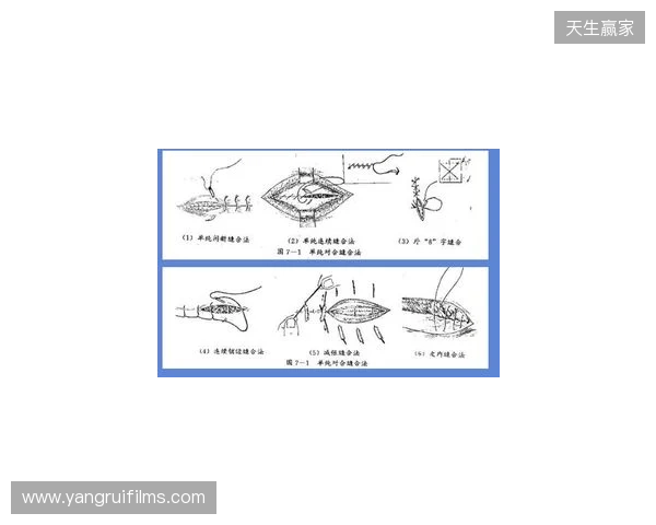 广州豹官方:杨浩眉弓伤口缝合30余针,预计5-7天后拆线 广州豹官方:杨浩眉弓伤口缝合30余针,预计5-7天后拆线